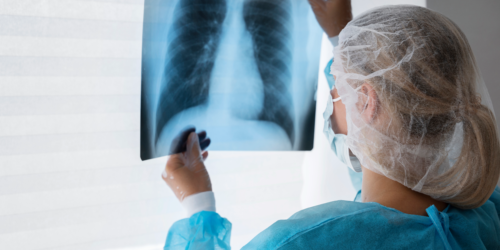 Lungenuntersuchungen Lungenuntersuchungen